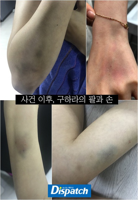 Không khám nghiệm tử thi, tang lễ Goo Hara cùng địa điểm với Sulli 3 tuần trước - Ảnh 3. Không khám nghiệm tử thi, tang lễ Goo Hara cùng địa điểm với Sulli 3 tuần trước - Ảnh 3.