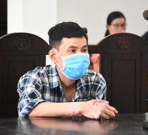 Vợ bị chồng đổ xăng đốt thương tật 88%: Hận thù cũng không được gì, xin giảm án cho anh ấy - Ảnh 2. Vợ bị chồng đổ xăng đốt thương tật 88%: Hận thù cũng không được gì, xin giảm án cho anh ấy - Ảnh 2.