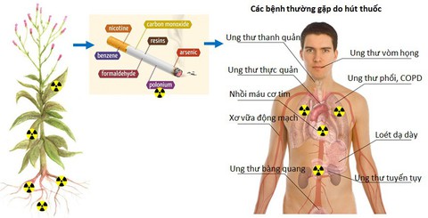 Chất phóng xạ trong thuốc lá gây nguy hiểm - Ảnh 2. Chất phóng xạ trong thuốc lá gây nguy hiểm - Ảnh 2.