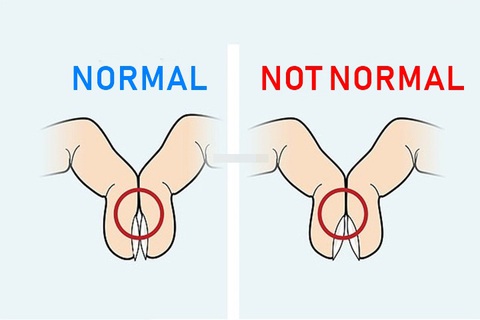 3 dấu hiệu ở ngón tay cảnh báo bạn có thể bị ung thư phổi - Ảnh 1. 3 dấu hiệu ở ngón tay cảnh báo bạn có thể bị ung thư phổi - Ảnh 1.
