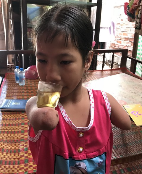 Ước mơ của cô học trò lớp 3 không tay, không chân - Ảnh 1. Ước mơ của cô học trò lớp 3 không tay, không chân - Ảnh 1.