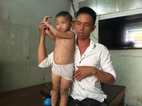 Bắt nghi can đặt thuốc nổ trong micro làm hai mẹ con bị thương - Ảnh 3. Bắt nghi can đặt thuốc nổ trong micro làm hai mẹ con bị thương - Ảnh 3.