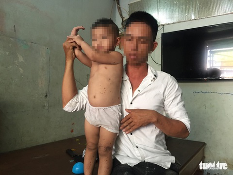Nghi án đặt thuốc nổ trong micro, 2 mẹ con bị thương - Ảnh 2. Nghi án đặt thuốc nổ trong micro, 2 mẹ con bị thương - Ảnh 2.
