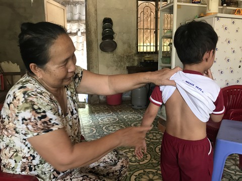 Cho phép bắn hạ con khỉ hoang cắn người ở Sóc Trăng - Ảnh 1. Cho phép bắn hạ con khỉ hoang cắn người ở Sóc Trăng - Ảnh 1.