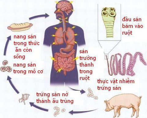 Hành trình sán chu du và kẹt... ở não - Ảnh 1. Hành trình sán chu du và kẹt... ở não - Ảnh 1.