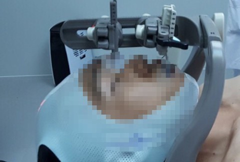 Giảm xạ trị ung thư đầu cổ từ 25-35 lần xuống còn 6 lần - Ảnh 1. Giảm xạ trị ung thư đầu cổ từ 25-35 lần xuống còn 6 lần - Ảnh 1.