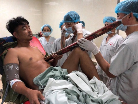 Cứu sống nam thanh niên bị thanh sắt to đâm thấu ngực - Ảnh 1. Cứu sống nam thanh niên bị thanh sắt to đâm thấu ngực - Ảnh 1.