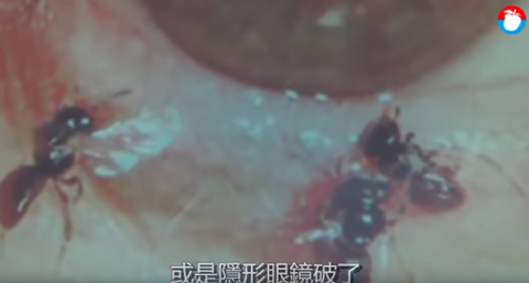 Phát hiện ong ký sinh trong mắt người, say sưa hút nước mắt - Ảnh 2. Phát hiện ong ký sinh trong mắt người, say sưa hút nước mắt - Ảnh 2.