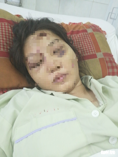 Khởi tố thanh niên trong nhóm đánh sẩy thai cô gái 18 tuổi vì món nợ 1,6 triệu đồng - Ảnh 1. Khởi tố thanh niên trong nhóm đánh sẩy thai cô gái 18 tuổi vì món nợ 1,6 triệu đồng - Ảnh 1.