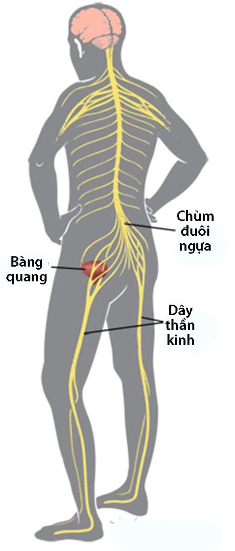 Hội chứng chùm đuôi ngựa - Ảnh 1. Hội chứng chùm đuôi ngựa - Ảnh 1.