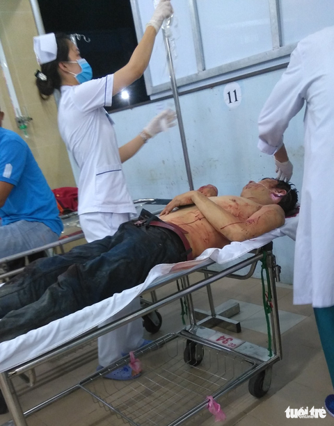 Bắt nghi phạm chém hàng xóm 17 nhát vì chê hát như nhạc đám ma - Ảnh 1. Bắt nghi phạm chém hàng xóm 17 nhát vì chê hát như nhạc đám ma - Ảnh 1.