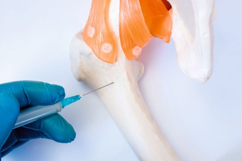 Nga thử nghiệm cấy ghép xương bằng kỹ thuật tế bào thế hệ mới - Ảnh 1. Nga thử nghiệm cấy ghép xương bằng kỹ thuật tế bào thế hệ mới - Ảnh 1.