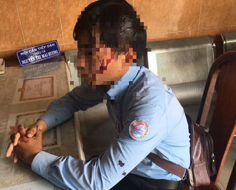 Nhân viên đi ghi chỉ số nước bị chó cắn, lại bị chủ chó đánh bể đầu - Ảnh 1. Nhân viên đi ghi chỉ số nước bị chó cắn, lại bị chủ chó đánh bể đầu - Ảnh 1.