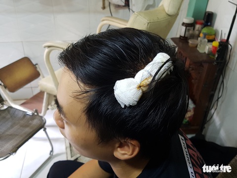 Vụ nhân viên ghi chỉ số nước bị chó cắn, đánh bể đầu: Con chó đã từng cắn người - Ảnh 3. Vụ nhân viên ghi chỉ số nước bị chó cắn, đánh bể đầu: Con chó đã từng cắn người - Ảnh 3.