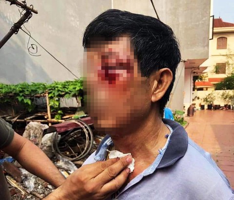 Xác minh nghi vấn đại úy công an đánh bác ruột bị thương - Ảnh 1. Xác minh nghi vấn đại úy công an đánh bác ruột bị thương - Ảnh 1.