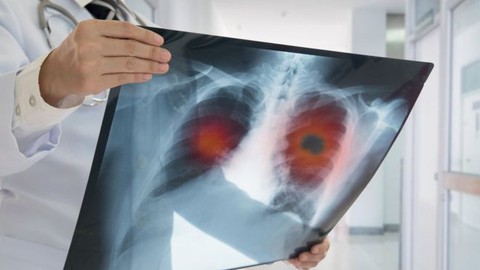 Trí tuệ nhân tạo giúp phát hiện sớm ung thư? - Ảnh 1. Trí tuệ nhân tạo giúp phát hiện sớm ung thư? - Ảnh 1.