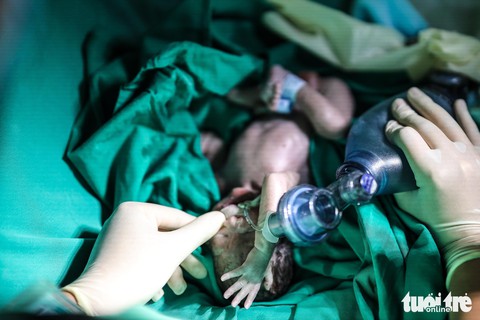 Xúc động ca mổ đặc biệt đón bé sơ sinh từ người mẹ ung thư giai đoạn cuối - Ảnh 8. Xúc động ca mổ đặc biệt đón bé sơ sinh từ người mẹ ung thư giai đoạn cuối - Ảnh 8.