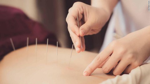 Lần đầu đưa Đông y vào sách, WHO khiến thầy thuốc Tây náo loạn - Ảnh 2. Lần đầu đưa Đông y vào sách, WHO khiến thầy thuốc Tây náo loạn - Ảnh 2.