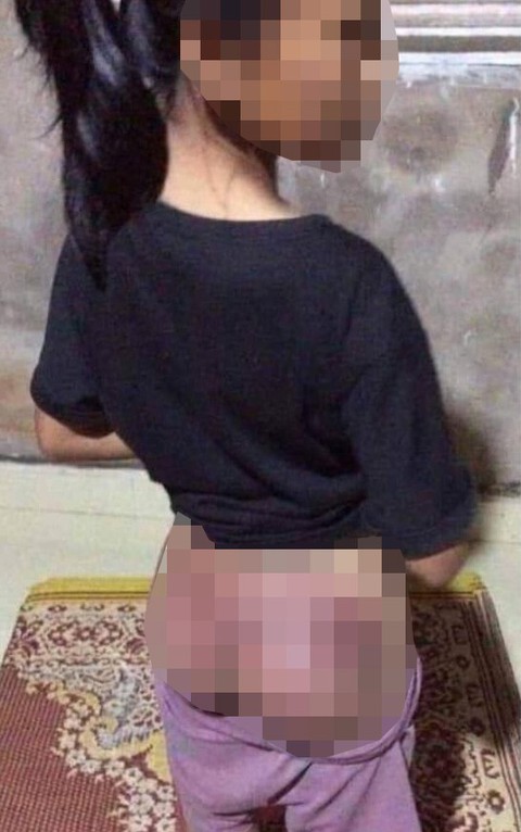 Công an viên dùng dùi cui cao su đánh bé gái thiểu năng nhập viện - Ảnh 1. Công an viên dùng dùi cui cao su đánh bé gái thiểu năng nhập viện - Ảnh 1.