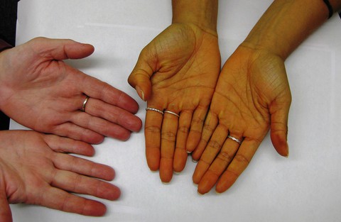 Dấu hiệu nhận biết bệnh gan các ma men nên đề phòng - Ảnh 1. Dấu hiệu nhận biết bệnh gan các ma men nên đề phòng - Ảnh 1.