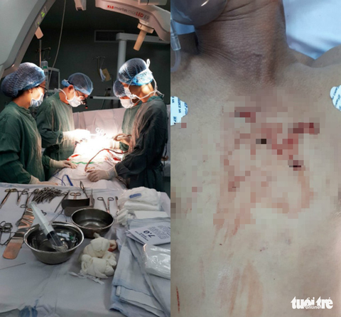 Cứu sống người đàn ông bị đâm thủng tim - Ảnh 1. Cứu sống người đàn ông bị đâm thủng tim - Ảnh 1.