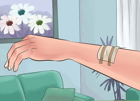 Chăm sóc trẻ tại nhà sau thủ thuật sinh thiết da - Ảnh 1. Chăm sóc trẻ tại nhà sau thủ thuật sinh thiết da - Ảnh 1.