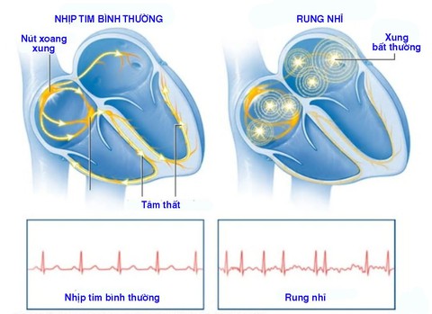 Hồi hộp - Ảnh 1. Hồi hộp - Ảnh 1.