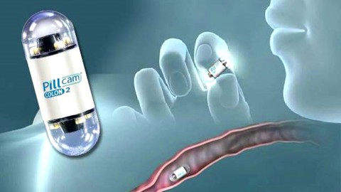 Nội soi đường tiêu hóa bằng viên nang - Ảnh 1. Nội soi đường tiêu hóa bằng viên nang - Ảnh 1.