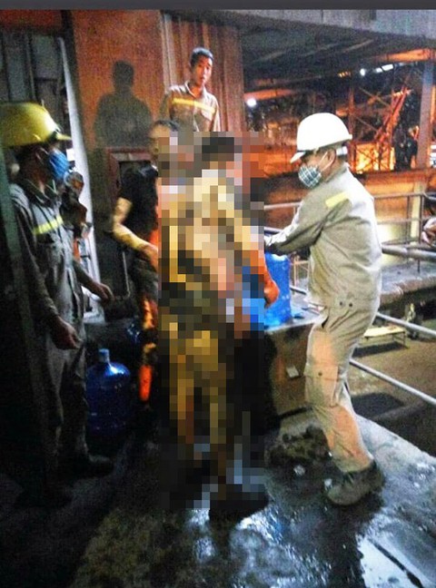 Đang giao ca thì sụt lò luyện gang, công nhân bỏng 80% cơ thể - Ảnh 1. Đang giao ca thì sụt lò luyện gang, công nhân bỏng 80% cơ thể - Ảnh 1.