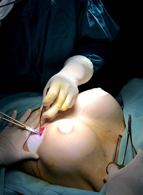 Dành cả thanh xuân đập đi xây lại gương mặt của mình - Ảnh 8. Dành cả thanh xuân đập đi xây lại gương mặt của mình - Ảnh 8.