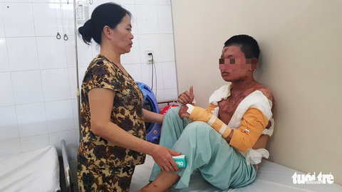 Nam sinh bị bỏng nặng vì bếp cồn trước ngày thi THPT - Ảnh 1. Nam sinh bị bỏng nặng vì bếp cồn trước ngày thi THPT - Ảnh 1.