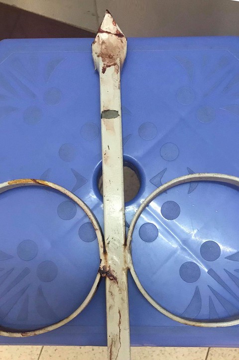 Tai nạn hi hữu: Cưa cọc sắt cổng cơ quan cứu bảo vệ bị trọng thương - Ảnh 3. Tai nạn hi hữu: Cưa cọc sắt cổng cơ quan cứu bảo vệ bị trọng thương - Ảnh 3.