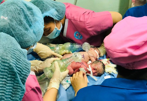 Mổ cứu an toàn hai bé gái song sinh dính chung hậu môn - Ảnh 1. Mổ cứu an toàn hai bé gái song sinh dính chung hậu môn - Ảnh 1.