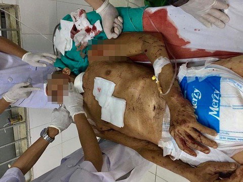 Bị hàng xóm 71 tuổi chém, cụ ông 83 tuổi nhập viện - Ảnh 1. Bị hàng xóm 71 tuổi chém, cụ ông 83 tuổi nhập viện - Ảnh 1.