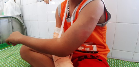 Bắt kẻ nghi cướp tiền, đánh bé bán vé số tàn nhẫn đến gãy tay - Ảnh 3. Bắt kẻ nghi cướp tiền, đánh bé bán vé số tàn nhẫn đến gãy tay - Ảnh 3.