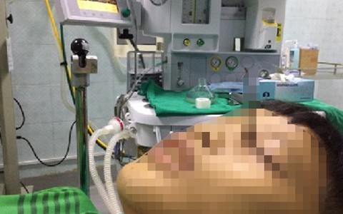 Một thiếu niên bị đinh găm vào hốc mắt do dùng súng tự chế - Ảnh 1. Một thiếu niên bị đinh găm vào hốc mắt do dùng súng tự chế - Ảnh 1.