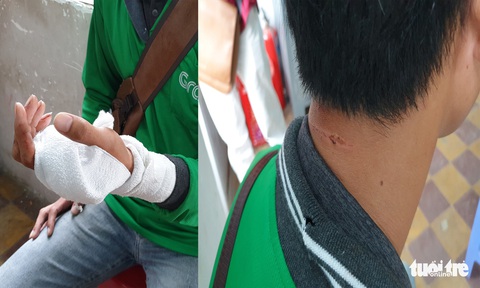 Bị đâm chảy máu, tài xế Grab vẫn quật ngã, bắt gọn tên cướp - Ảnh 2. Bị đâm chảy máu, tài xế Grab vẫn quật ngã, bắt gọn tên cướp - Ảnh 2.