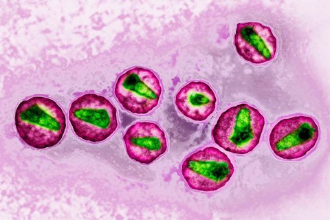 Giới khoa học đã ở rất gần cách chữa bệnh HIV/AIDS - Ảnh 1. Giới khoa học đã ở rất gần cách chữa bệnh HIV/AIDS - Ảnh 1.