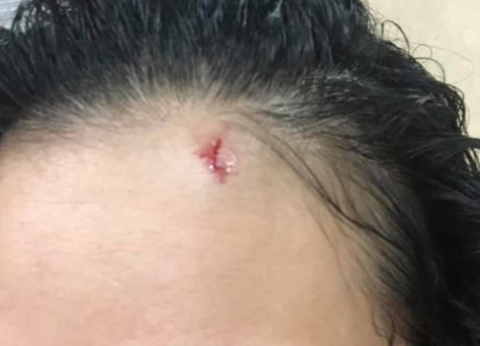 Ném đá vào ôtô trên cao tốc Hà Nội - Thái Nguyên khiến hành khách bị thương - Ảnh 3. Ném đá vào ôtô trên cao tốc Hà Nội - Thái Nguyên khiến hành khách bị thương - Ảnh 3.