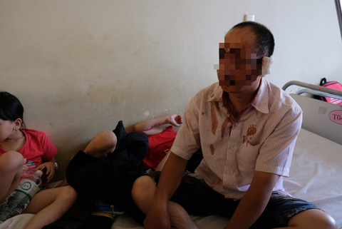 Vụ tai nạn xe khách ở Khánh Hòa: Mùa hè sau, cháu không dám về quê bằng xe nữa - Ảnh 1. Vụ tai nạn xe khách ở Khánh Hòa: Mùa hè sau, cháu không dám về quê bằng xe nữa - Ảnh 1.