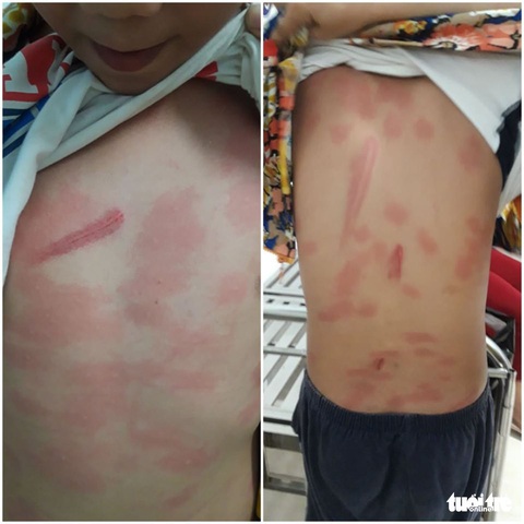 Khởi tố cô ruột vì đánh cháu thương tích 13 % - Ảnh 1. Khởi tố cô ruột vì đánh cháu thương tích 13 % - Ảnh 1.