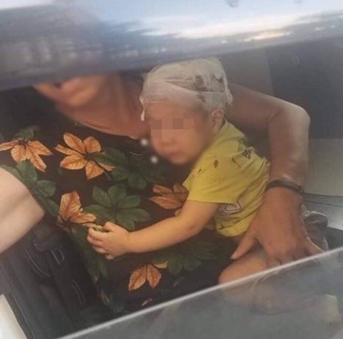 Bé trai phải cấp cứu vì bị cây lau nhà từ tầng 17 chung cư rơi trúng đầu - Ảnh 1. Bé trai phải cấp cứu vì bị cây lau nhà từ tầng 17 chung cư rơi trúng đầu - Ảnh 1.