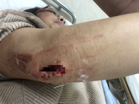 Nhóm thanh niên bịt mặt lao vào nhà chém một phụ nữ - Ảnh 2. Nhóm thanh niên bịt mặt lao vào nhà chém một phụ nữ - Ảnh 2.