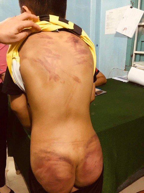 Điều tra vụ cháu bé 11 tuổi bị bạo hành dã man tại cơ sở thờ tự - Ảnh 1. Điều tra vụ cháu bé 11 tuổi bị bạo hành dã man tại cơ sở thờ tự - Ảnh 1.