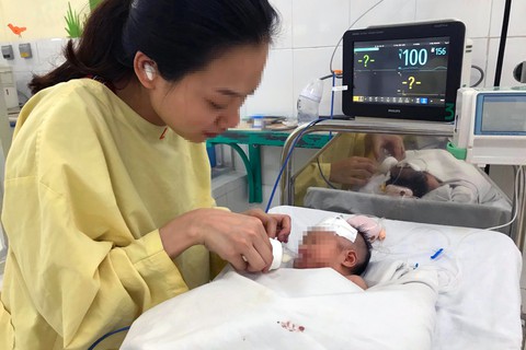 Cứu sống bé gái sinh non tắc tá tràng bẩm sinh - Ảnh 1. Cứu sống bé gái sinh non tắc tá tràng bẩm sinh - Ảnh 1.