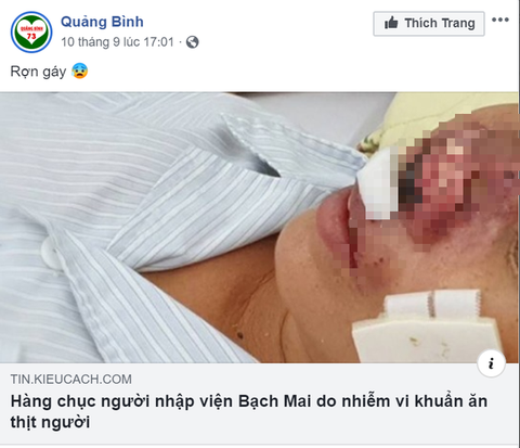Quảng Bình bác tin đồn có bệnh nhân nhiễm vi khuẩn ăn thịt người Whitmore - Ảnh 1. Quảng Bình bác tin đồn có bệnh nhân nhiễm vi khuẩn ăn thịt người Whitmore - Ảnh 1.