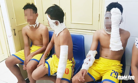 Chùm bóng bay phát nổ, ba cầu thủ U14 SLNA nhập viện - Ảnh 1. Chùm bóng bay phát nổ, ba cầu thủ U14 SLNA nhập viện - Ảnh 1.