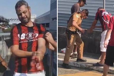 Video cổ động viên Brazil bị mất bàn tay vì pháo phát nổ - Ảnh 2. Video cổ động viên Brazil bị mất bàn tay vì pháo phát nổ - Ảnh 2.