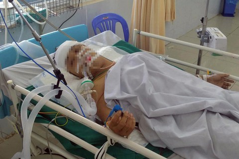 Cứu sống bệnh nhân bị đâm thủng phổi, xuyên sọ não - Ảnh 1. Cứu sống bệnh nhân bị đâm thủng phổi, xuyên sọ não - Ảnh 1.