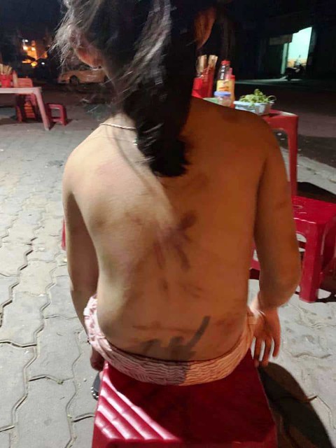 Xác minh vụ cháu bé 6 tuổi bị đánh lằn roi khắp người - Ảnh 3. Xác minh vụ cháu bé 6 tuổi bị đánh lằn roi khắp người - Ảnh 3.